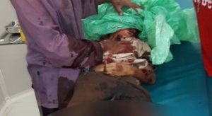 Duarrr …Granat Meledak, Satu Anak Tewas, Dua Luka Parah