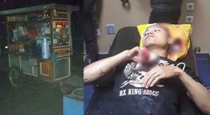 Hanya Gara-gara Ini, Penjual Nasgor Dibacok Hingga Jarinya Putus