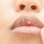 Bibir kering (ilustrasi)