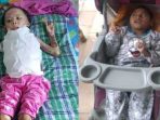 14 Difabel Butuh Uluran Tangan