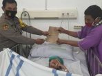 Bocah Perempuan asal Jampangtengah Terbakar, Mulai Membaik