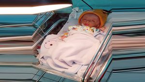 Cepat Sembuh Ya Hifza, Bayi Dua Bulan di Sukabumi Menderita Hidrosefalus