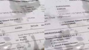 Ketika Kertas Hasil Swab Covid-19 Dijadikan Bungkus Gorengan
