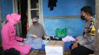 Kapolres Sukabumi Jenguk Bocah Penderita Hydrocephalus