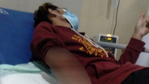 Asyik Makan Rujak, Warga Selawangi Sukabumi Dibacok