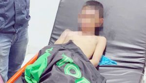 Bocah 8 Tahun Asal Sukajaya Sukabumi Tersiram Air Panas, Terkapar di Rumah Sakit
