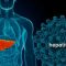 Hepatitis