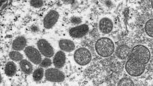 Waspada Virus Hendra Kembali Muncul, Ini Gejalanya saat Lompat ke Manusia