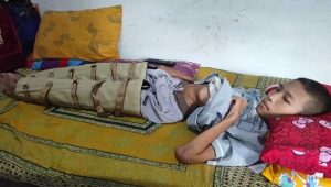 Sang Juara Kelas di Kota Sukabumi Terbaring Lemas, Fauzan Ingin Sembuh, Butuh Biaya Untuk Operasi