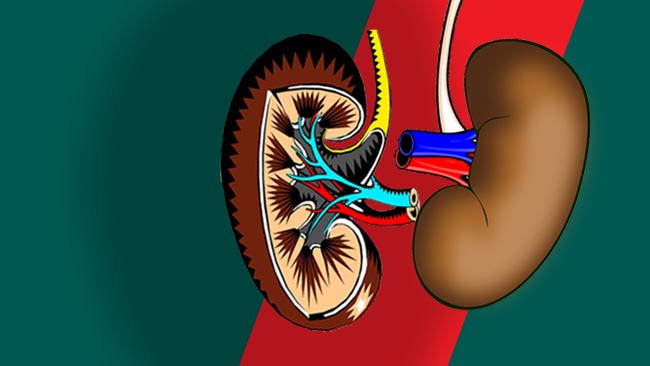 Ilustrasi: Gagal ginjal akut pada anak di