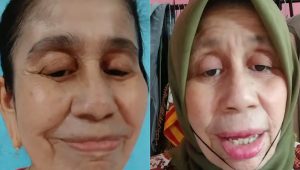 Viral, Wajah Wanita Asal Bogor Sudah Seperti Nenek-nenek Padahal Umurnya baru 28 tahun, Ini Penyebabnya
