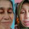 Heboh di media sosial, wajah seorang wanita berusia 28