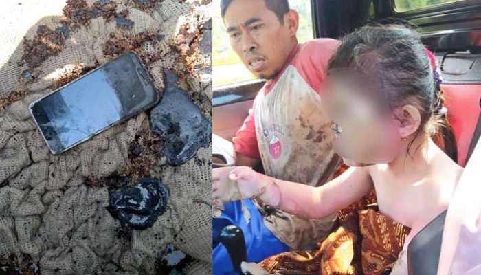 Bocah SD di Cidahu Sukabumi Sekujur Tubuh Terbakar, Gara-gara Main Handphone