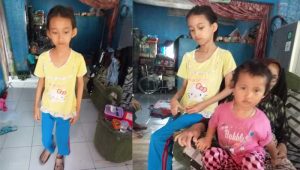 Bocah SD Pengidap Gizi Buruk di Desa Cimangkok Sukabumi Kini Kondisinya Membaik