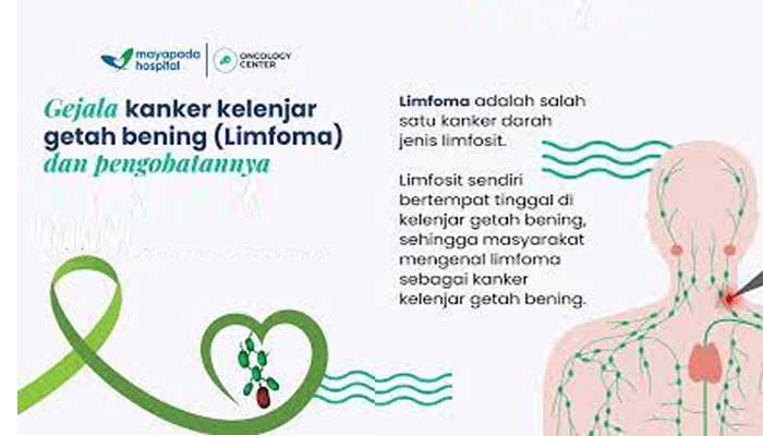 Kanker Darah Limfoma