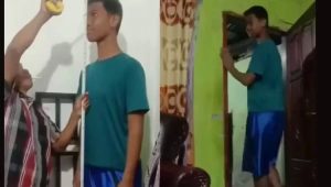 Melihat Anak SD Kelas 6 Miliki Tinggi Badan 2 Meter di Jambi