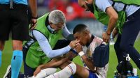 Penampakan Mbappe Cedera Patah Tulang Hidung