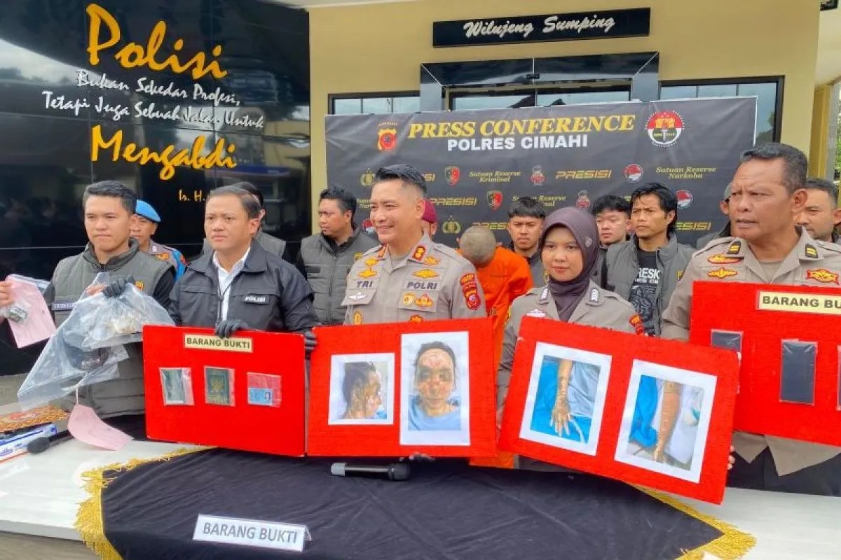 Kapolres Cimahi AKBP Tri Suhartanto (tengah) saat ungkap kasus penyiraman air keras kepada istrinya di Cimahi, Jawa Barat. (Polres Cimahi)