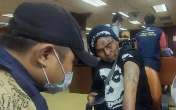 Seorang warga Jakarta Barat, Dima (30) mengikuti kegiatan penghapusan tato yang diselenggarakan BAZNAS (BAZIS) di kantor Wali Kota Jakarta Barat, Rabu (27/3/2024).