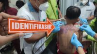 Potret Ibu dan Anak di Baros Kota Sukabumi Disiram Air keras