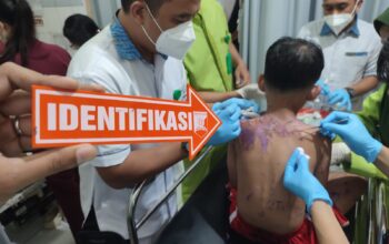 Kasus penyiraman air keras yang menimpa seorang ibu dan anak di Kota Sukabumi menggegerkan warga dan menjadi perhatian serius pihak kepolisian.