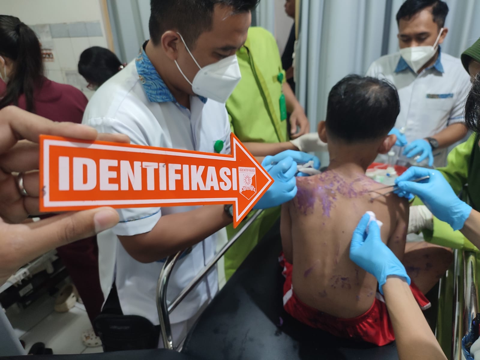 Kasus penyiraman air keras yang menimpa seorang ibu dan anak di Kota Sukabumi menggegerkan warga dan menjadi perhatian serius pihak kepolisian.
