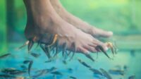Terapi Ikan Untuk Mengatasi Penyakit Psoriasis