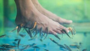 Terapi Ikan Untuk Mengatasi Penyakit Psoriasis