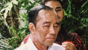 Dokter Tifa Sebut Sakit Kulit Jokowi Akibat Stres Berat